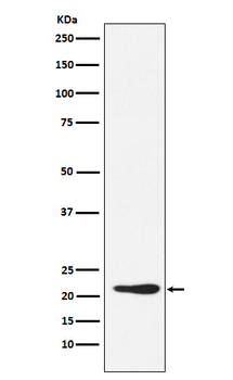 GDF3 Rabbit mAb Antibody