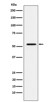 MMP1 Rabbit mAb Antibody