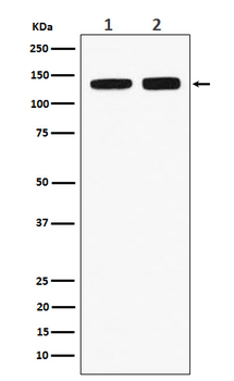 RNF40 Rabbit Monoclonal Antibody