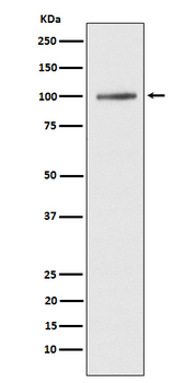 ATP2A1/SERCA1 Rabbit mAb