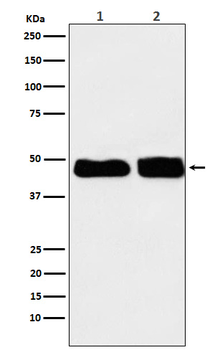 C4 binding protein Rabbit mAb Antibody