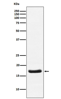 Cardiac Troponin C Rabbit mAb Antibody
