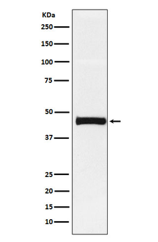 Pentraxin 3 Rabbit mAb Antibody