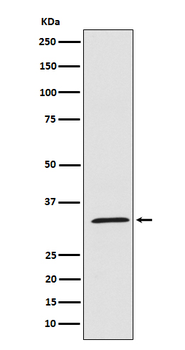UCP1+UCP3 Rabbit mAb Antibody