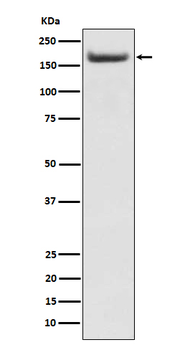 IRS2 Rabbit Monoclonal Antibody