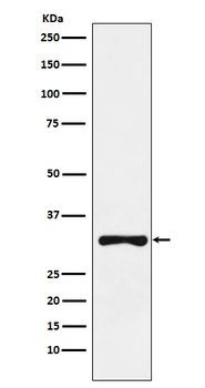 RYBP Rabbit mAb Antibody