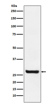 Sprouty 4 Rabbit mAb Antibody