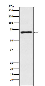 SLC6A1 / GAT1 Rabbit mAb Antibody