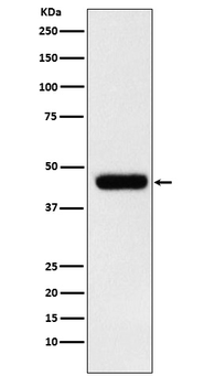 eIF4A1 Rabbit mAb [KD Validated]