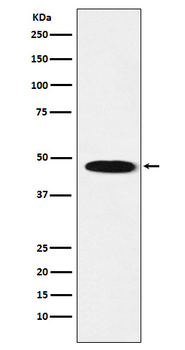 GABA A Receptor beta 1 Rabbit Monoclonal Antibody