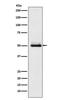 Cytochrome P450 2C9 Rabbit mAb Antibody
