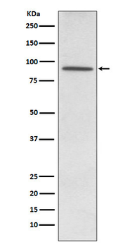 PDE4D Rabbit Monoclonal Antibody