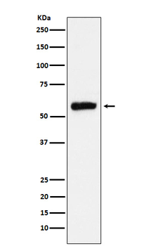 ALDH2 Rabbit mAb Antibody