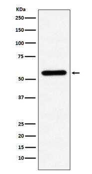 Liver Carboxylesterase 1 Rabbit Monoclonal Antibody