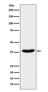 TRBP Rabbit mAb Antibody