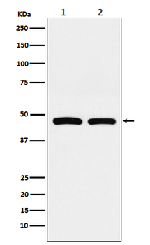 FDFT1 Rabbit mAb Antibody