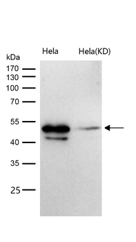ABHD5 Rabbit mAb [KD Validated] Antibody
