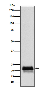 FSH beta (FSHB) Rabbit Monoclonal Antibody