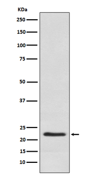 Placental lactogen Rabbit Monoclonal Antibody