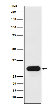 HLA-Drb1 Rabbit Monoclonal Antibody