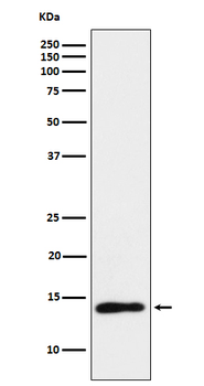 TCL1 Rabbit mAb