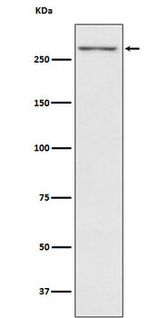Thyroglobulin Rabbit mAb Antibody