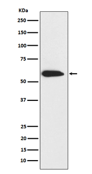 Cytokeratin 6 Rabbit mAb Antibody