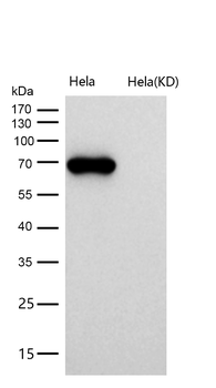 Alkaline phosphatase Rabbit mAb [KD Validated] Antibody