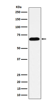 Alkaline phosphatase Rabbit mAb [KD Validated] Antibody