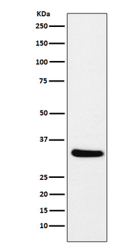 CRALBP Rabbit mAb Antibody