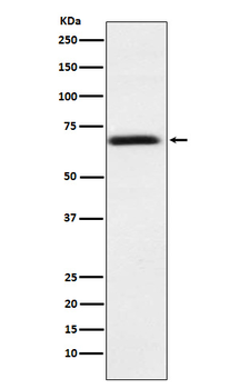 PMP70 Rabbit Monoclonal Antibody