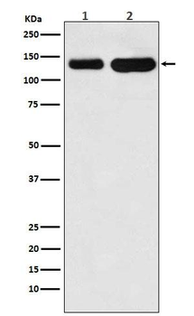 CDH6 Rabbit Monoclonal Antibody