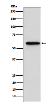 Retinoic Acid Receptor beta Rabbit mAb Antibody