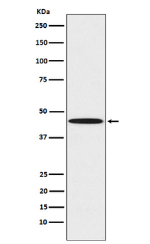 PEDF Rabbit Monoclonal Antibody