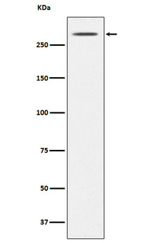 Thyroglobulin Rabbit mAb Antibody