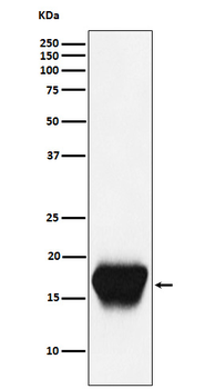 CD52 Rabbit Monoclonal Antibody
