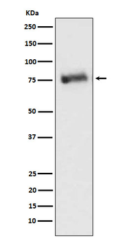GRK3 Rabbit Monoclonal Antibody