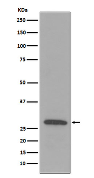 C1QB Rabbit Monoclonal Antibody