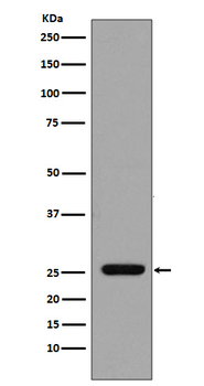 GST Rabbit mAb Antibody