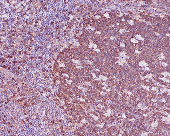 beta I Tubulin Rabbit mAb