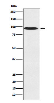CDT2 Rabbit Monoclonal Antibody