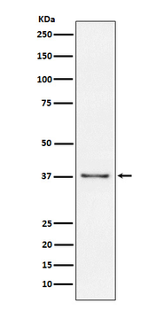 CD23 Rabbit Monoclonal Antibody