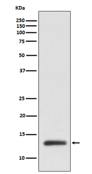 ROC1 Rabbit mAb