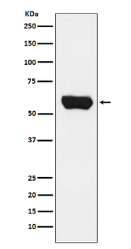 Lck Rabbit mAb Antibody