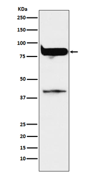 PKC eta Rabbit mAb Antibody