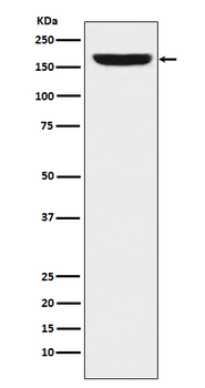 REST / NRSF Rabbit mAb Antibody