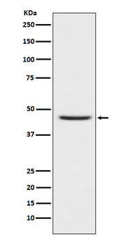 CCR8 Rabbit mAb Antibody
