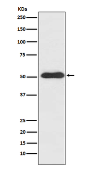 Slit2 Rabbit Monoclonal Antibody