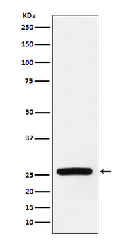 Superoxide Dismutase 3 Rabbit mAb Antibody