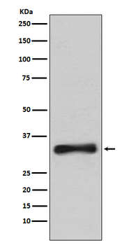 Emerin Rabbit mAb Antibody